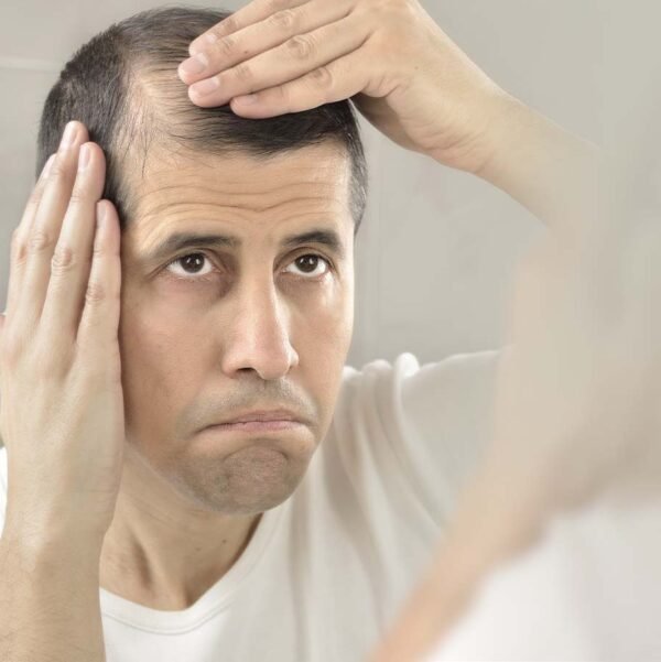 PRP (Platelet-Rich Plasma)