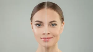 Top Anti-Aging Treatments